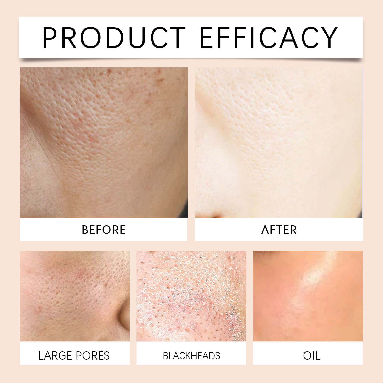 Gentle Exfoliating Gel &ndash; Cleansing, Moisturizing & Oil-Control Face Wash (9)