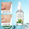 Aloe Vera Deep Hydration & Soothing Face Serum