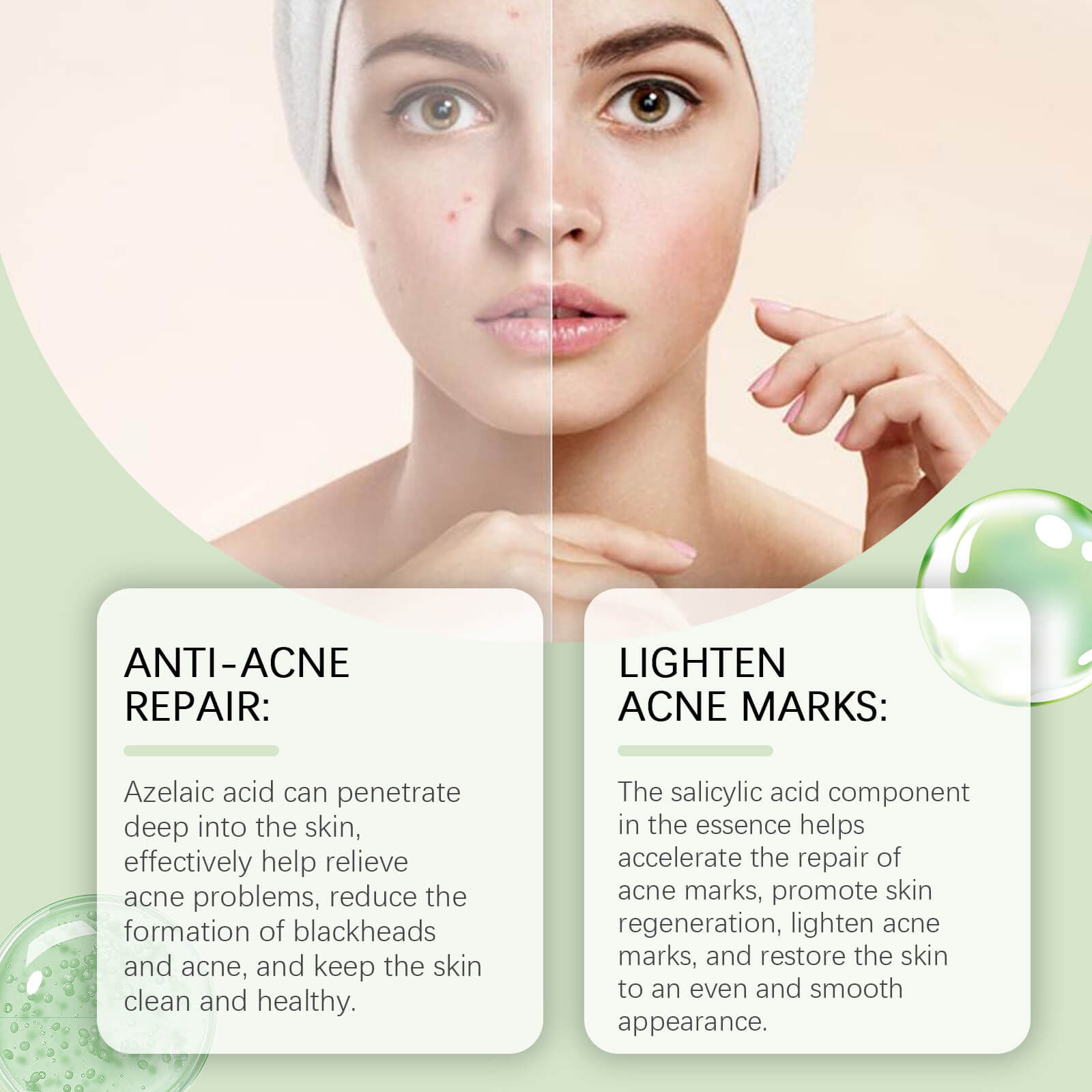 Azelaic Acid Clarifying Serum Oil Control, Acne & Blackhead Reduction, Hydrating & Smooth Skin (7)