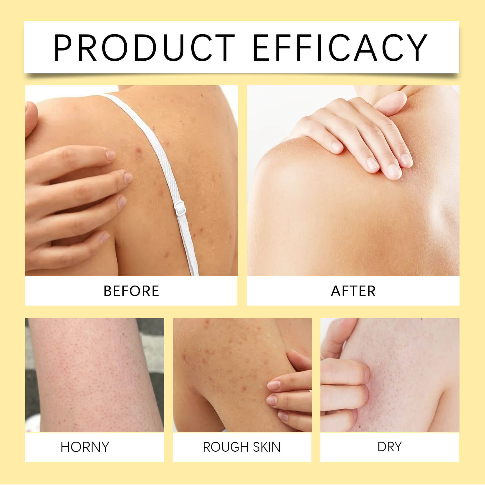 Sulfur Refreshing Body Wash &ndash; Gentle Cleanse, Moisturizing & Acne Care (8)