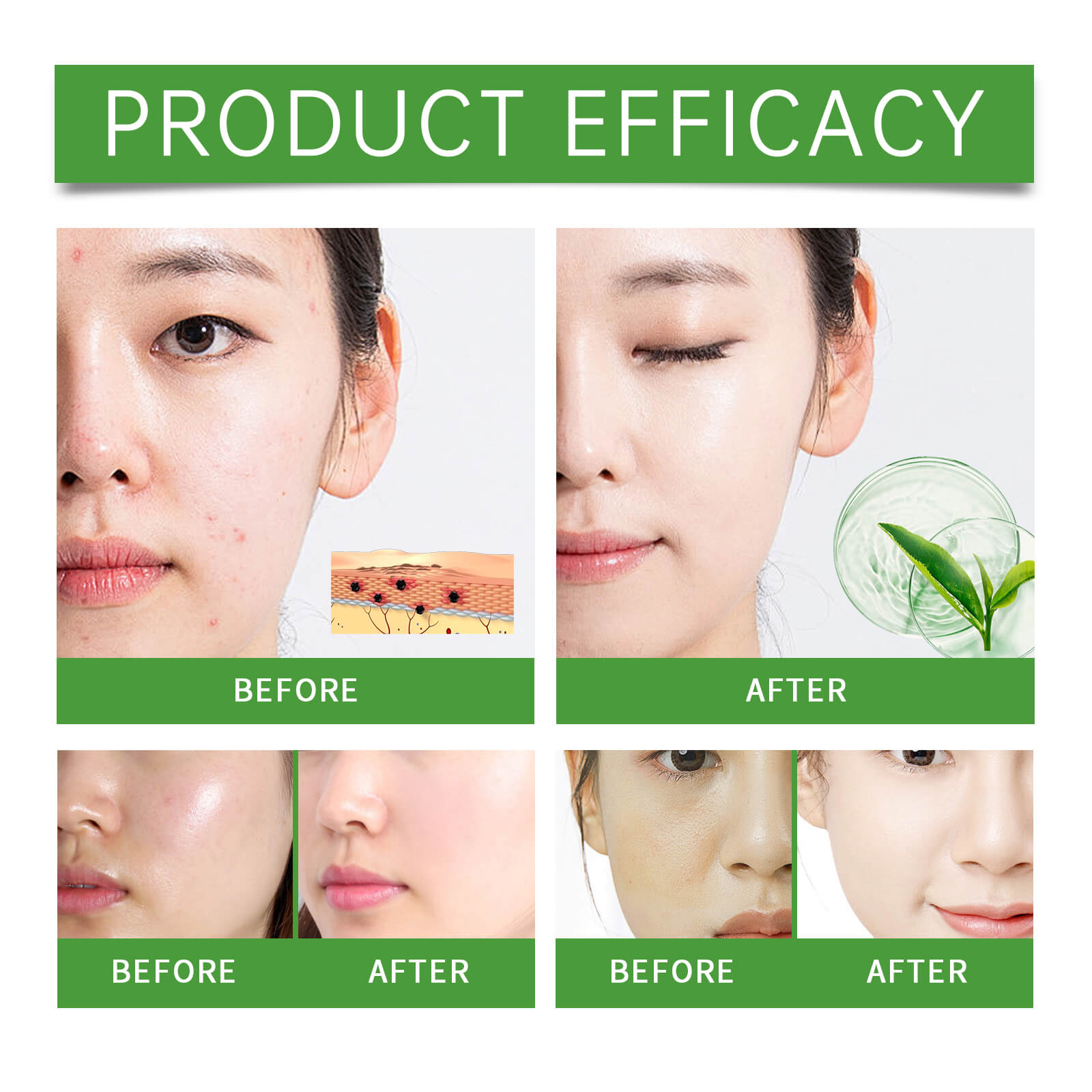 Tea Tree Oil Purifying Face Gel &ndash; Gentle Deep Cleansing, Oil Control & Hydrating Facial Cleanser (9)