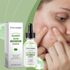Azelaic Acid Clarifying Serum | Oil Control, Acne & Blackhead Reduction, Hydrating & Smooth Skin