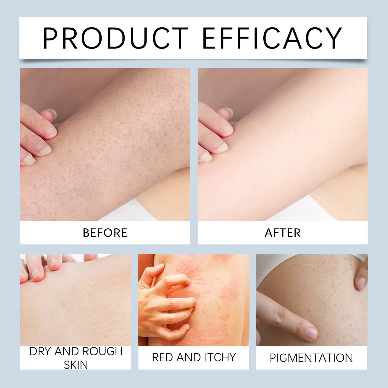 Salicylic Acid Body Wash &ndash; Gentle Exfoliation, Oil Control & Moisturizing Care (9)