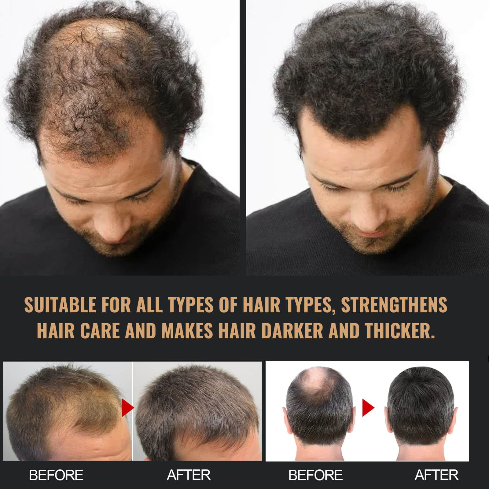 Hair Thickening & Strengthening Shampoo Anti-Hair Loss, Dense, Strong, Smooth & Repairing (10)