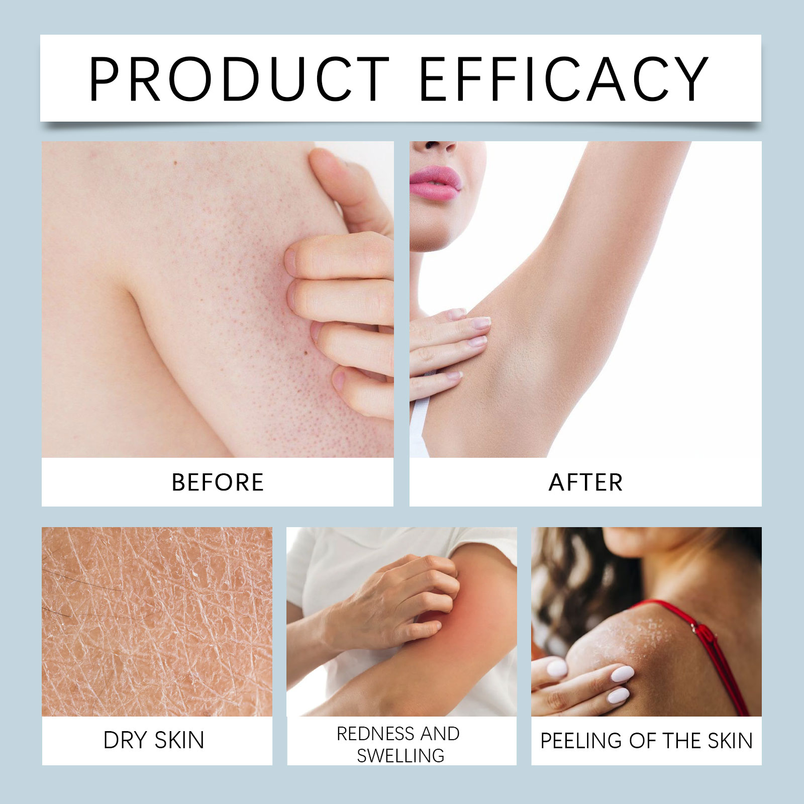 Niacinamide Moisturizing Body Lotion &ndash; Gentle Hydration & Soothing, Improves Skin Tone (9)