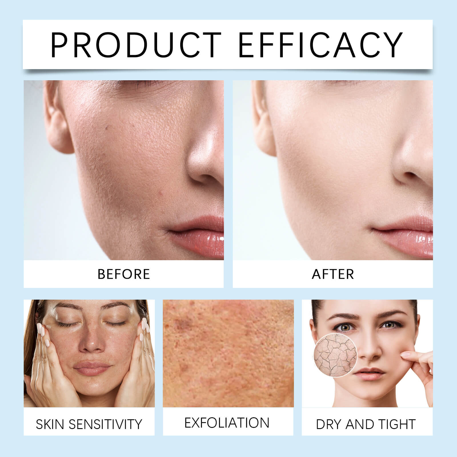 Deep Hydrating Toner &ndash; Daily Moisturizing, Soothing and Smoothing Rough Skin (9)