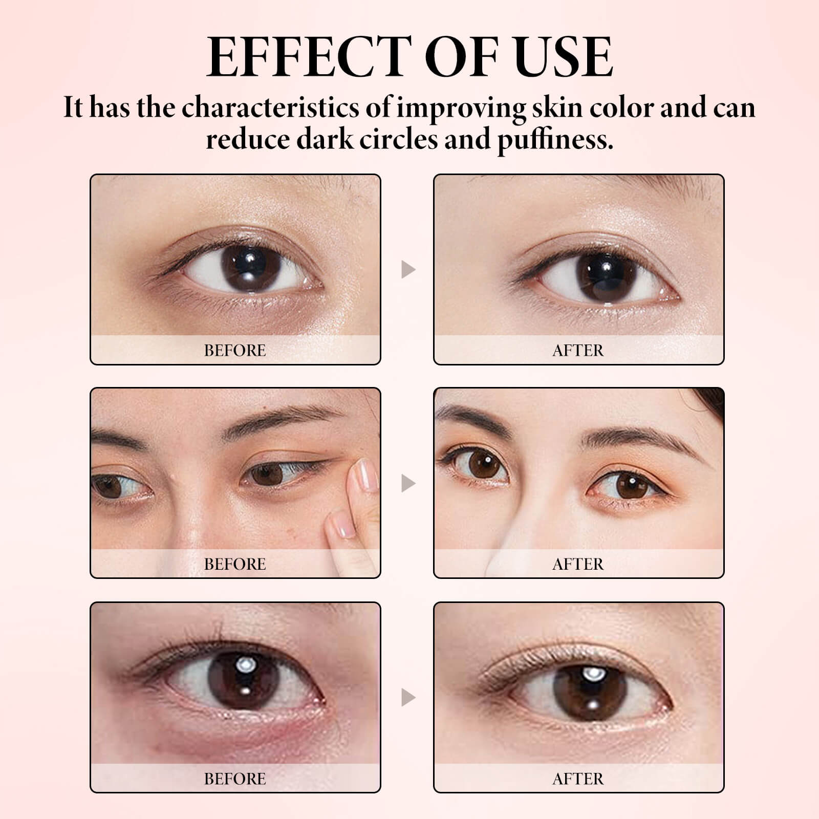 Retinol Anti-Aging Eye Cream Stick Reduces Dark Circles & Eye Bags, Firms Fine Lines, Hydrates and Nouris ( (9)