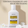 Anti-Dandruff Shampoo – Mild, Anti-Itch & Flake Control Shampoo for All Hair Types