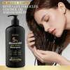 5% Minoxidil & Biotin Shampoo – Anti Hair Loss, Hair Growth & Oil Control Shampoo